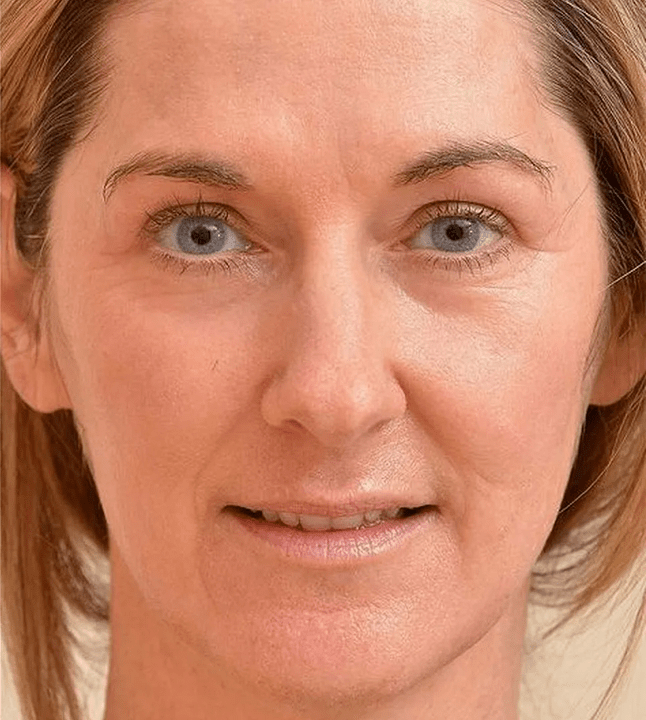 J'ai l'air plus jeune après avoir appliqué la crème Eudalie