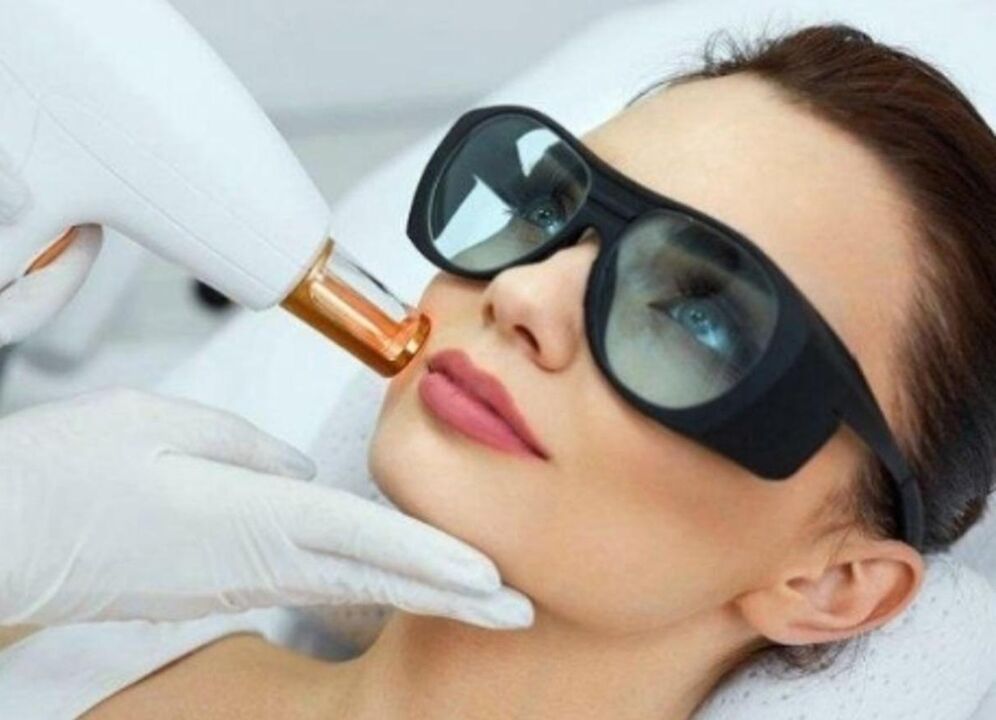 Rajeunissement de la peau du visage