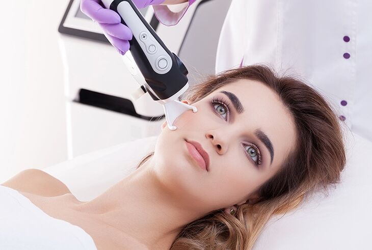 Rajeunissement au laser